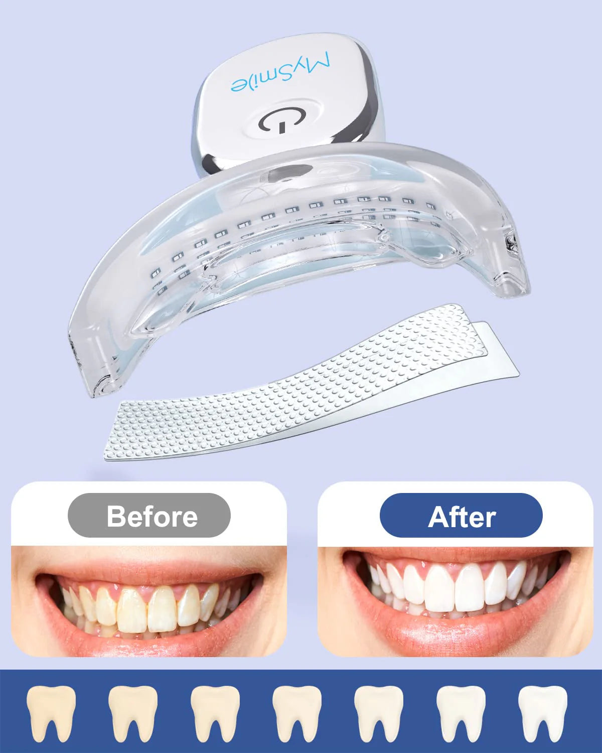 KIT DE BLANQUEAMIENTO DENTAL CON LUZ LED